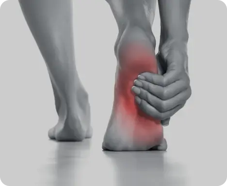 Flat Feet Discomfort